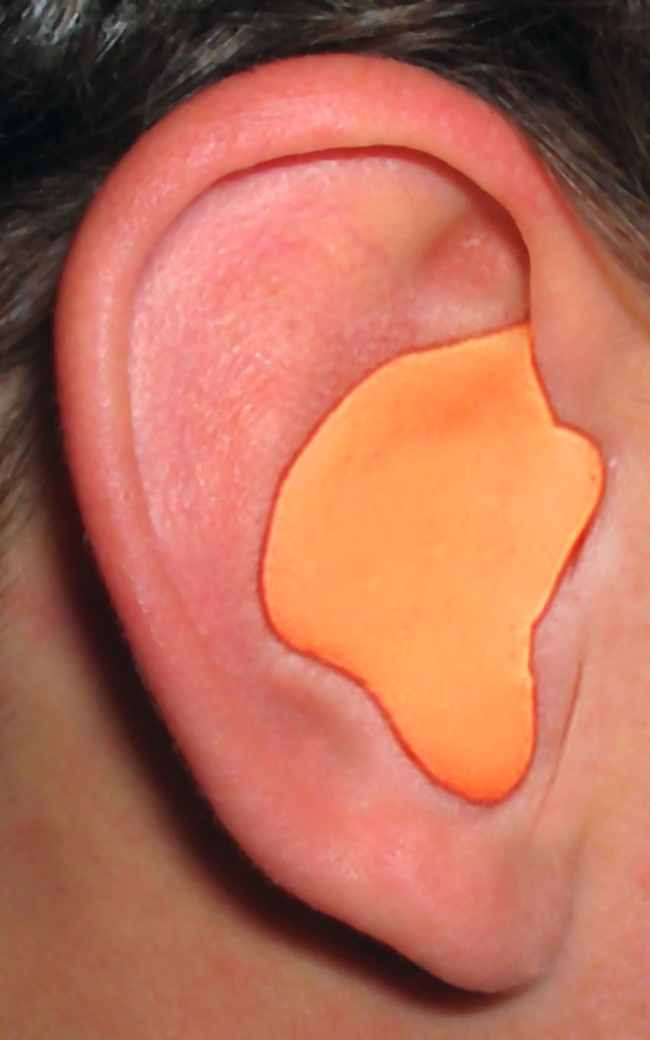 RADIANS CUSTOM MOLDED EARPLUGS